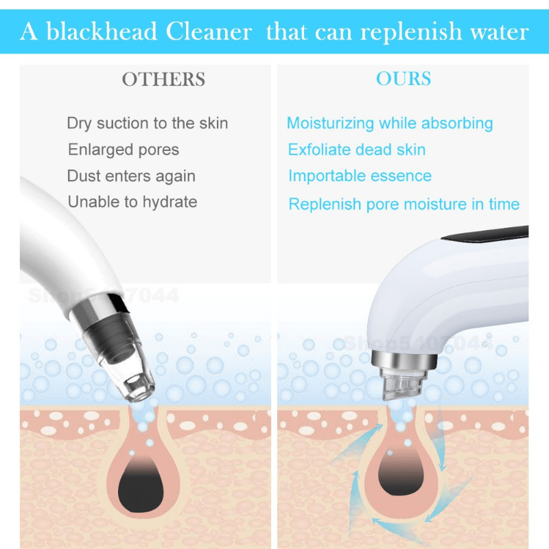 Electric Vacuum Blackhead Acne Pore Cleaner Water Cycle Skin Deep .